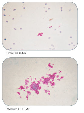 Examples of colonies derived from human megakaryocyte progenitors