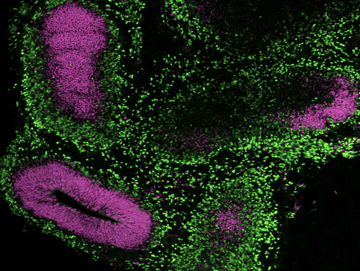 Immunocytochemistry image of a cerebral organoid cultured in mTeSR™ Plus and directed to cerebral organoids using the STEMdiff™ Cerebral Organoid Kit.