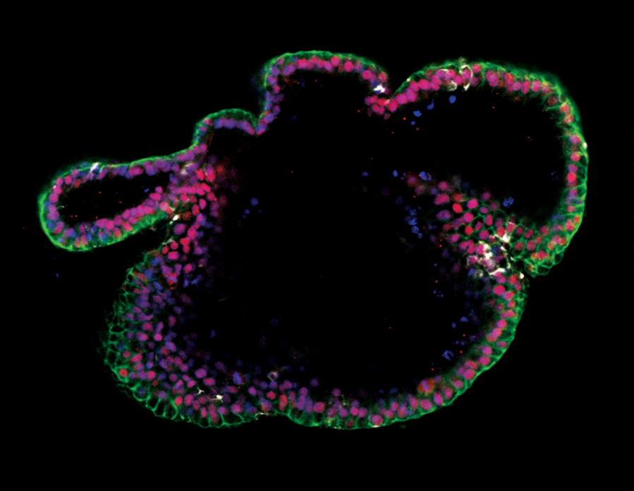 Immunocytochemistry image of an intestinal organoid cultured in mTeSR™ Plus and directed to intestinal organoids using the STEMdiff™ Intestinal Organoid Kit.