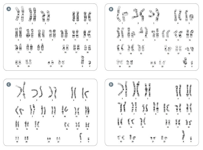 hPSCs Frozen and Thawed as Single Cells with FreSR™-S Display a Normal Karyotype