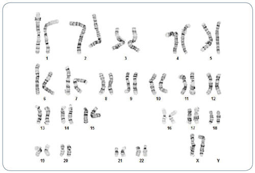 Human ES Cells Cultured Long-Term in TeSR™2 Retain Normal Karyotype