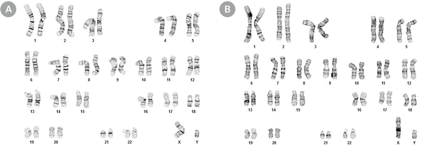 Clonal Cell Lines Established Using CloneR™ Display a Normal Karyotype
